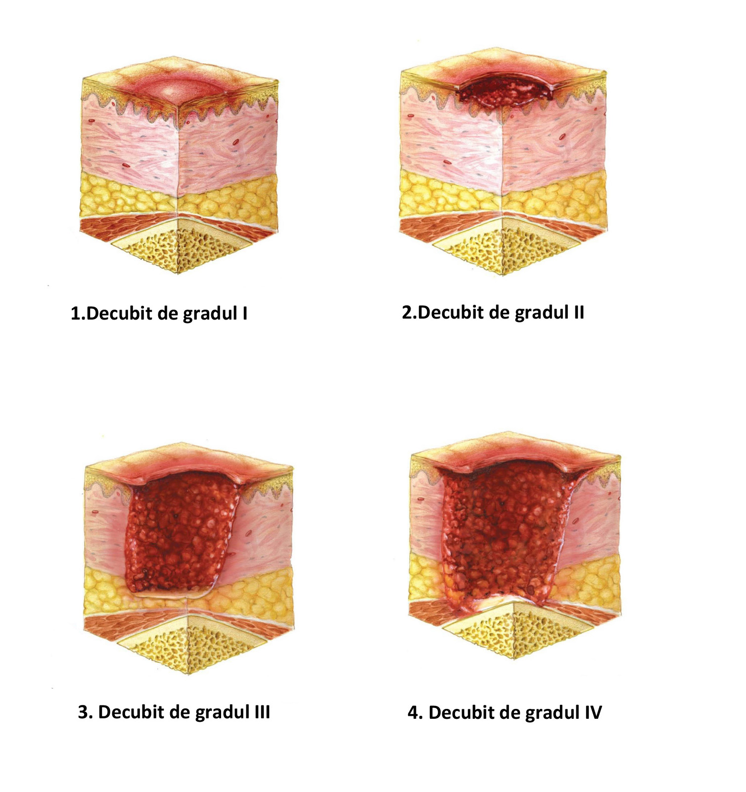 Saltea antidecubit cu compresor UNIZDRAV