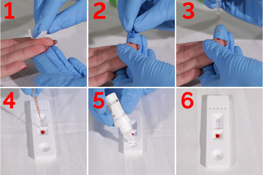 Test rapid pentru ANTICORPI după vaccinare  COVID-19, pachet de 25