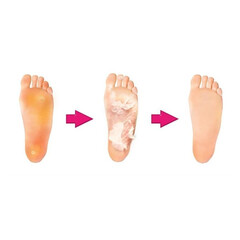 Șosete exfoliante pentru tălpi, 4 bucăți  REDUCERE, EXPIRARE 19.5.2025