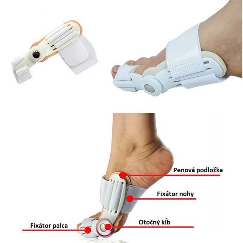 Orteză de noapte pentru hallux valgus