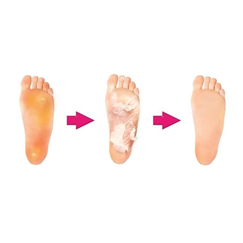 Șosete exfoliante pentru tălpi, 4 bucăți  REDUCERE, EXPIRARE 19.5.2025